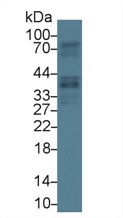 Western Blot; Sample: Human Lung lysate; <br/>Primary Ab: 1µg/ml Rabbit Anti-Human GAS2 Antibody<br/>Second Ab: 0.2µg/mL HRP-Linked Caprine Anti-Rabbit IgG Polyclonal Antibody<br/>(Catalog: SAA544Rb19)