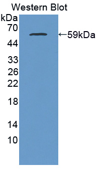 Western Blot; Sample: Recombinant protein.