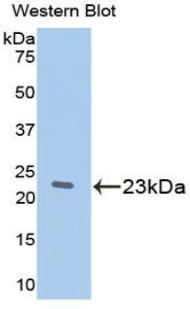 Western Blot; Sample: Recombinant protein.
