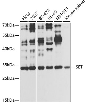 Anti-SET Antibody