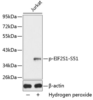 Anti-eIF2a (phospho S51) Antibody