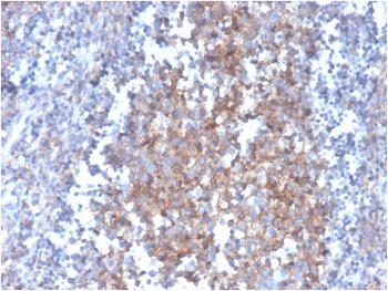 IHC staining of FFPE human tonsil with Fas Ligand antibody (clone FASLG/4455). HIER: boil tissue sections in pH 9 10mM Tris with 1mM EDTA for 20 min and allow to cool before testing.
