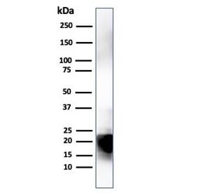 Western blot testing of human brain lysate with Myelin Basic Protein antibody (clone MBP/4274). Isoforms may be visualized from 20~37 kDa.