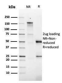 Anti-GM-CSF Antibody [CSF2/3403]