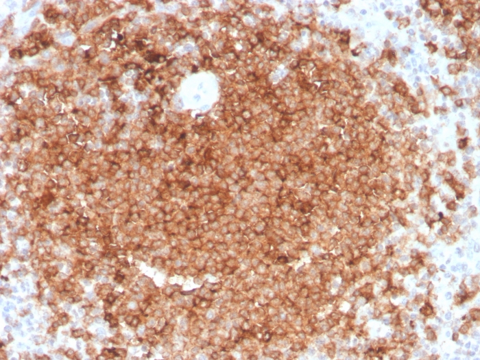 Anti-GM-CSF Antibody [CSF2/3403]