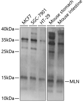 Anti-MLN Antibody
