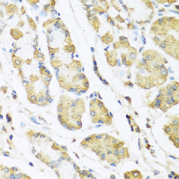 Anti-MLN Antibody