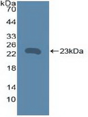 Western Blot; Sample: Recombinant TNFRSF5, Human.