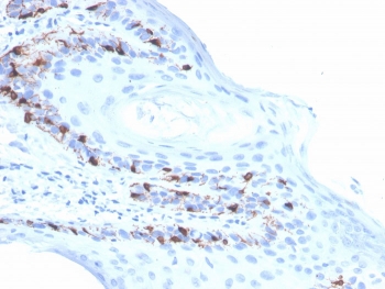 IHC staining of FFPE human skin with recombinant Melan-A antibody (clone rMLANA/4576). HIER: boil tissue sections in pH 9 10mM Tris with 1mM EDTA for 20 min and allow to cool before testing.