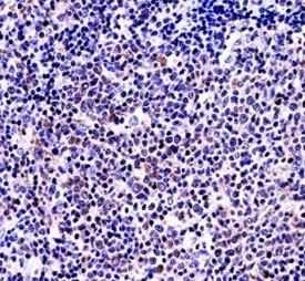 BAFF antibody immunohistochemistry analysis in formalin fixed and paraffin embedded human tonsil tissue.