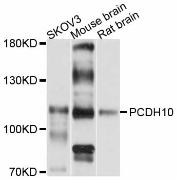 Anti-PCDH10 Antibody