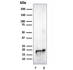 Western blot testing of human 1) JEG-3 and 2 )LNCaP cell lysate using SOD1 antibody (clone SOD1/4329). Predicted molecular weight ~16 kDa.