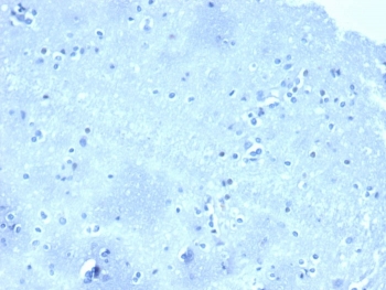 Negative tissue control: IHC analysis of formalin-fixed, paraffin-embedded human brain stained with CTNND1/4501 at 2ug/ml in PBS for 30min RT. HIER: boil tissue sections in pH 9 10mM Tris with 1mM EDTA for 20 min and allow to cool before testing.