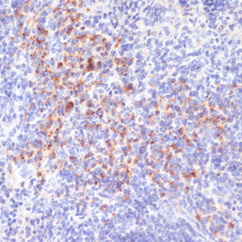 Anti-IRE1alpha (phospho S724) Antibody