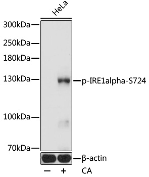 Anti-IRE1alpha (phospho S724) Antibody