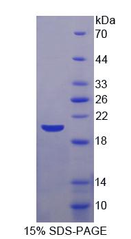 Figure. SDS-PAGE