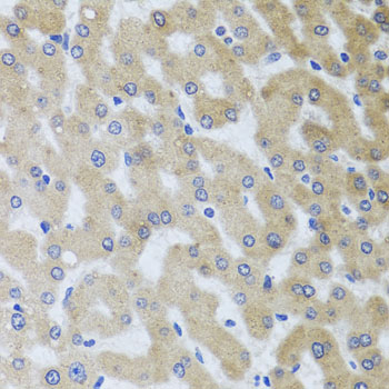 Anti-UVRAG Antibody