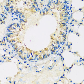 Anti-ABCF2 Antibody