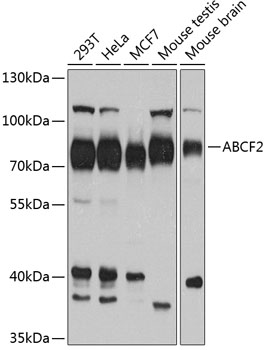 Anti-ABCF2 Antibody