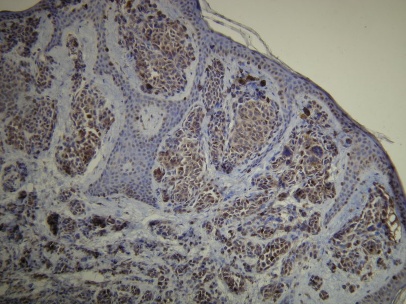 Anti-S-100 Antibody [D28-E]