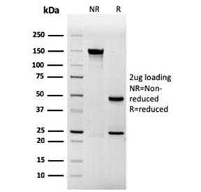 SDS-PAGE analysis of purified, BSA-free recombinant Involucrin antibody (clone rIVRN/827) as confirmation of integrity and purity.