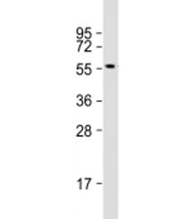 Western blot testing of human MOLT4 cell lysate with ETS1 antibody at 1:500. Predicted molecular weight: 50 kDa.