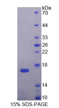 Figure. SDS-PAGE
