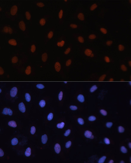 Anti-RB1 Antibody