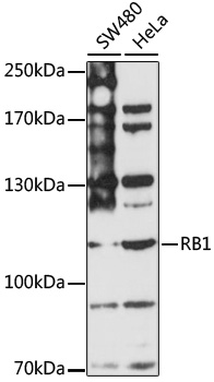 Anti-RB1 Antibody