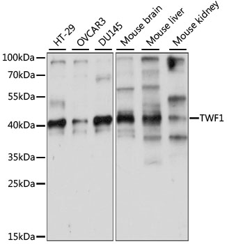 Anti-TWF1 Antibody