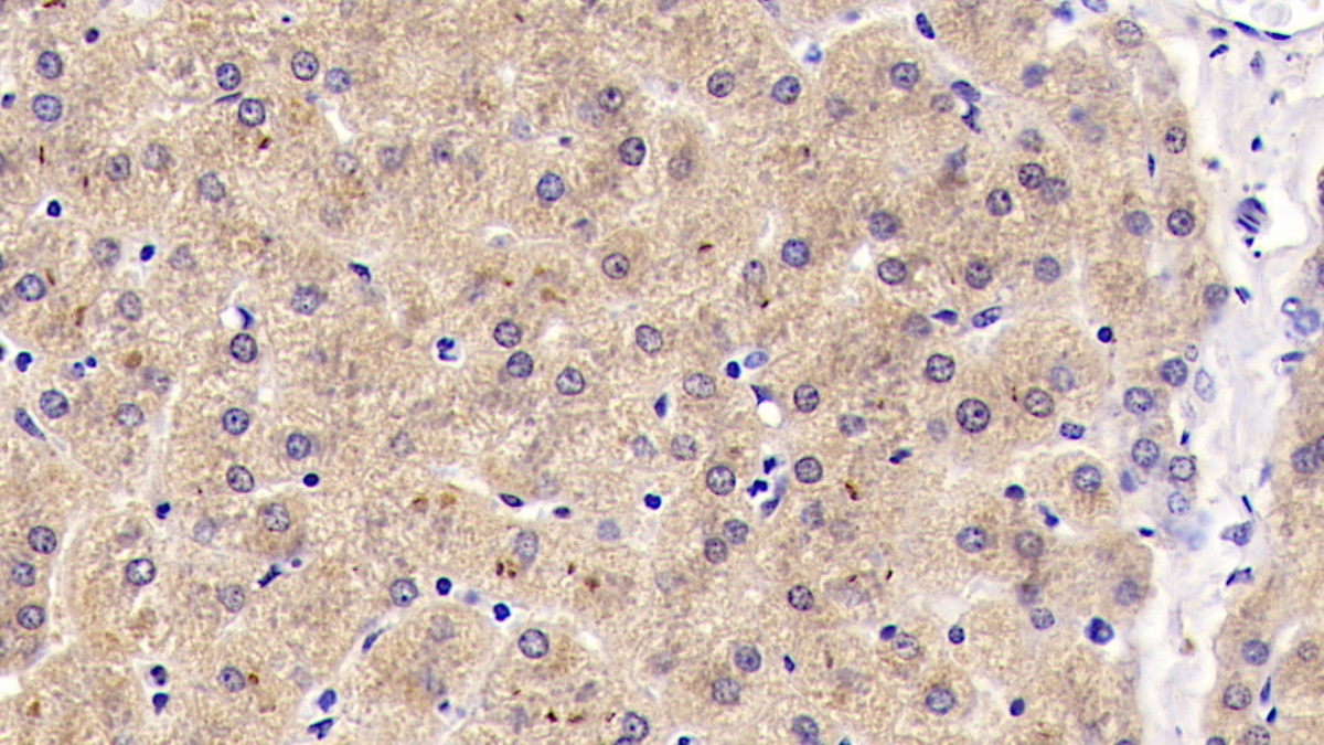 DAB staining on IHC-P; Samples: Human Liver Tissue;  Primary Ab: 20µg/ml Mouse Anti-Human Reelin Antibody Second Ab: 2µg/mL HRP-Linked Caprine Anti-Mouse IgG Polyclonal Antibody (Catalog: SAA544Mu19)