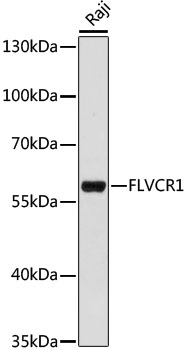 Anti-FLVCR1 Antibody