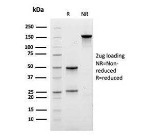 SDS-PAGE analysis of purified, BSA-free recombinant EPX antibody as confirmation of integrity and purity.