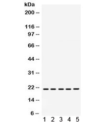 Western blot testing of 1) rat brain, 2) rat liver, 3) rat kidney, 4) human MCF7 and 5) human SW620 lysate with RAPA1 antibody. Expected/observed molecular weight ~21 kDa.