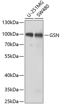 Anti-GSN Antibody