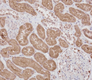IHC testing of FFPE human kidney tissue with RPS18 antibody. HIER: steam section in pH9 EDTA for 20 min and allow to cool prior to staining.