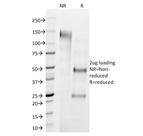 SDS-PAGE analysis of purified, BSA-free Cytokeratin 1 antibody (clone LHK1) as confirmation of integrity and purity.