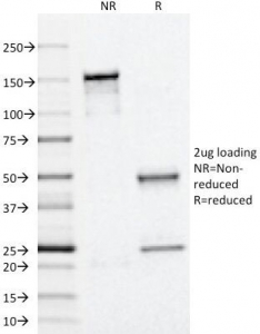 SDS-PAGE Analysis of Purified, BSA-Free Perilipin 2 Antibody (clone ADFP/1366). Confirmation of Integrity and Purity of the Antibody.