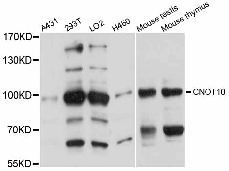 Anti-CNOT10 Antibody