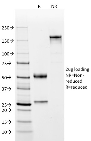 Anti-C4d Antibody [C4D204] (CF® 488)