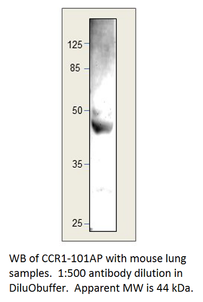 Anti-CCR1 Antibody