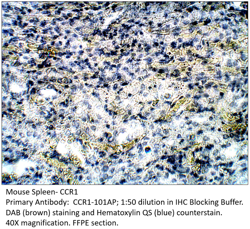 Anti-CCR1 Antibody