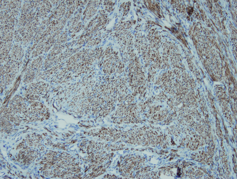 Anti-Desmin Antibody [E18-V]