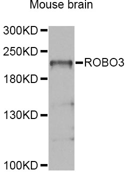 Anti-ROBO3 Antibody