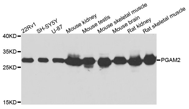 Anti-PGAM2 Antibody