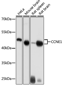 Anti-CCNE1 Antibody