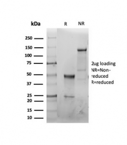 SDS-PAGE analysis of purified, BSA-free recombinant CFTR antibody (clone CFTR/6477R) as confirmation of integrity and purity.