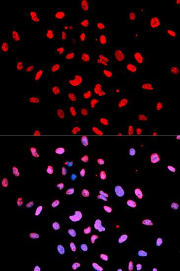 Anti-Btk (phospho Y223) Antibody