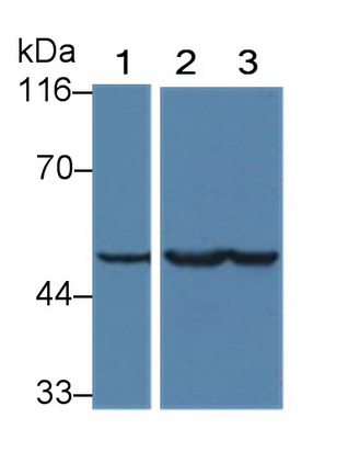Western Blot; Sample: Lane1: Hela cell lysate; Lane2: Rat Cerebrum lysate; Lane3: Porcine Cerebrum lysate Primary Ab: 2µg/ml Mouse Anti-Human NSE Antibody Second Ab: 0.2µg/mL HRP-Linked Caprine Anti-Mouse IgG Polyclonal Antibody (Catalog: SAA544Mu19)