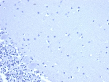 Negative control: IHC staining of FFPE human brain tissue using CD44 antibody (clone rHCAM/6449) at 2ug/ml in PBS for 30min RT. HIER: boil tissue sections in pH 9 10mM Tris with 1mM EDTA for 20 min and allow to cool before testing.